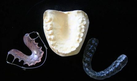 dreaming of braces