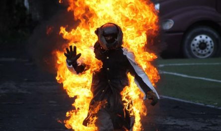 dreaming of being burned by fire