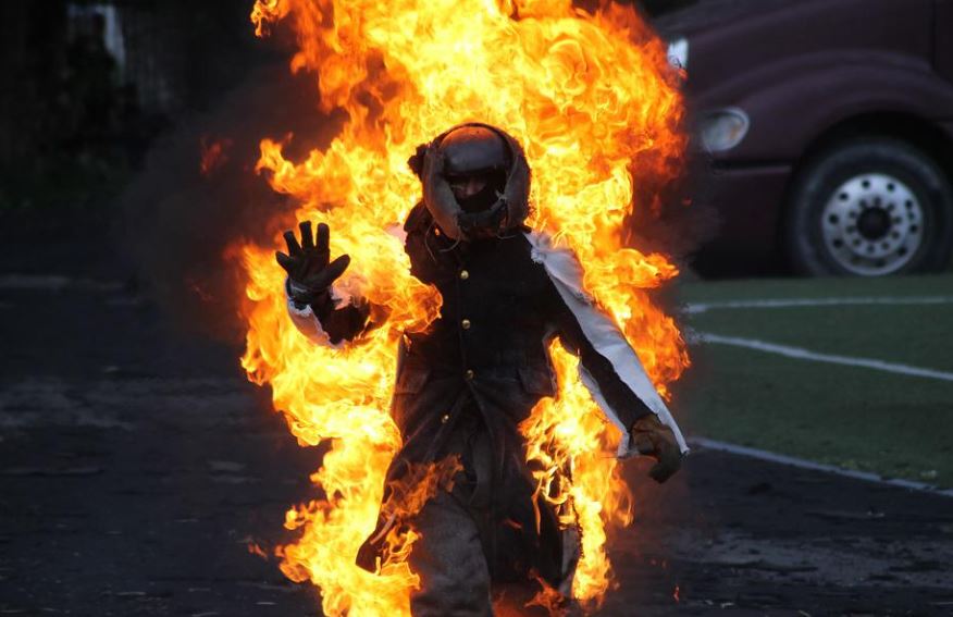 dreaming of being burned by fire
