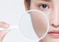 5 symbolic meanings of dreaming of age spots