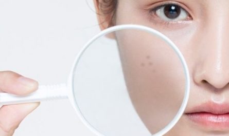 5 symbolic meanings of dreaming of age spots