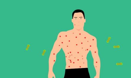 6 symbolic meanings of dreaming of chickenpox