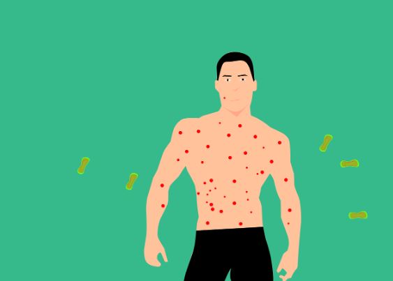 6 symbolic meanings of dreaming of chickenpox