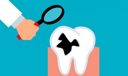 6 symbolic meanings of dreaming about tooth decay
