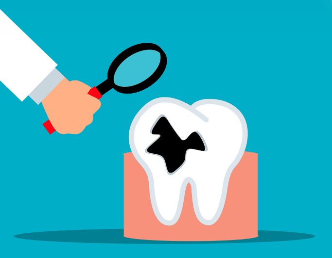 6 symbolic meanings of dreaming about tooth decay