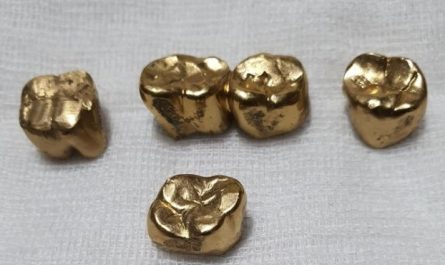 7 symbolic meanings of dreaming of golden teeth