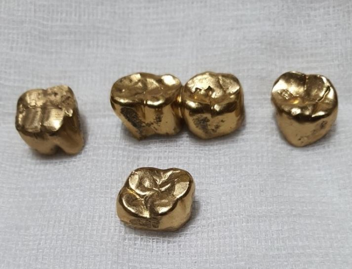 7 symbolic meanings of dreaming of golden teeth