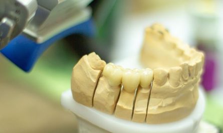 6 symbolic meanings of dreaming of dentures
