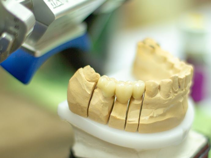 6 symbolic meanings of dreaming of dentures