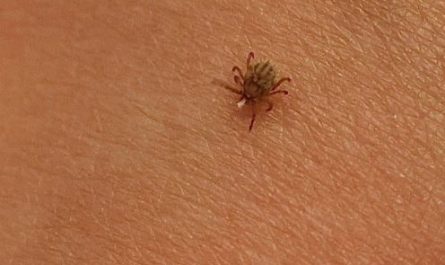 5 Spiritual Meanings of Dreaming of ticks