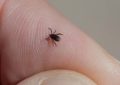 5 Spiritual Meanings of Dream about removing a tick