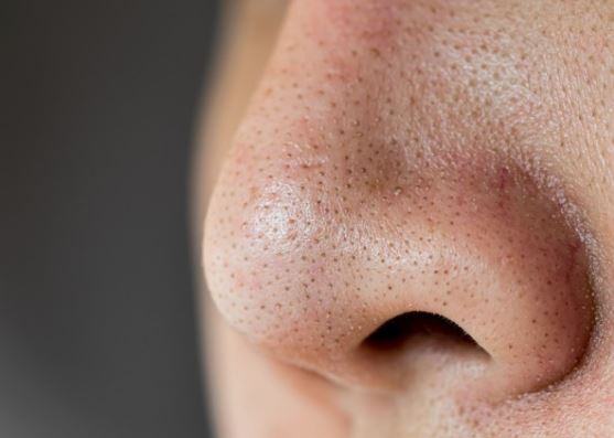 5 Spiritual Meanings of Dream about sebum coming out of the nose