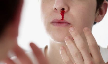 5 Spiritual Meanings of Dream about nosebleeds
