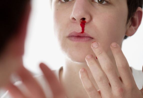 5 Spiritual Meanings of Dream about nosebleeds