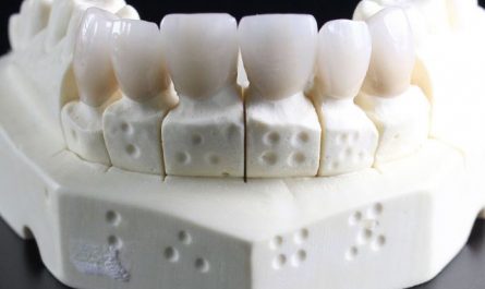 Dreaming of False Teeth : 9 Meaning & Interpretations