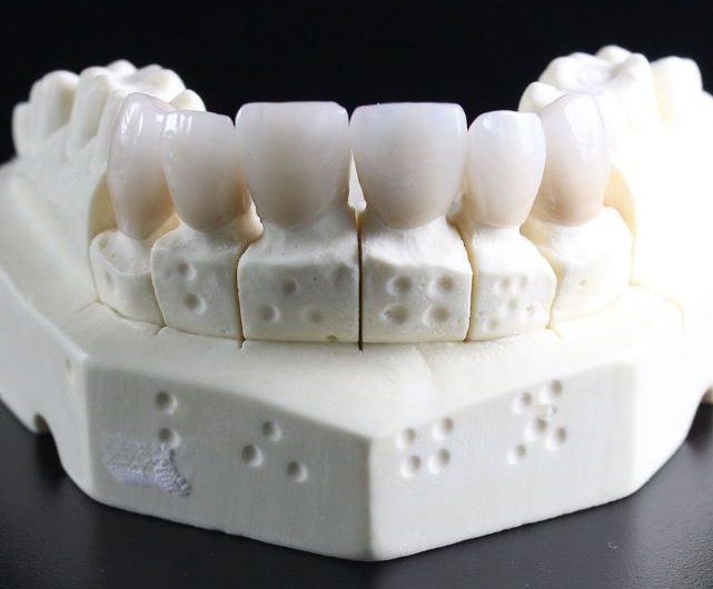 Dreaming of False Teeth : 9 Meaning & Interpretations