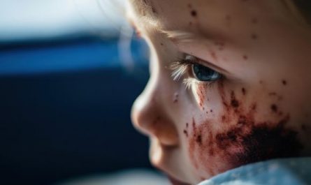9 Symbolic Meanings of Dreams about Bloodstains